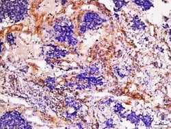 Collagen 1 Rabbit anti-Human, Polyclonal, Bioss 100 &mu;L; Unconjugated:Antibodies,