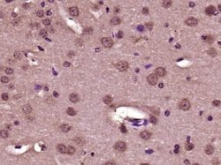 Collagen 1 Rabbit anti-Human, Polyclonal, Bioss 100 &mu;L; Unconjugated:Antibodies,