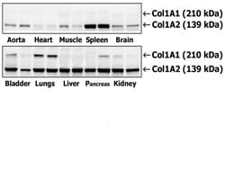 Collagen 1 Rabbit anti-Human, Polyclonal, Bioss 100 &mu;L; Unconjugated:Antibodies,