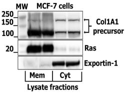 Collagen 1 Rabbit anti-Human, Polyclonal, Bioss 100 &mu;L; Unconjugated:Antibodies,