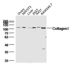 Collagen 1 Rabbit anti-Human, Polyclonal, Bioss 100 &mu;L; Unconjugated:Antibodies,