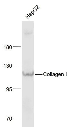Collagen 1 Rabbit anti-Human, Polyclonal, Bioss 100 &mu;L; Unconjugated:Antibodies,