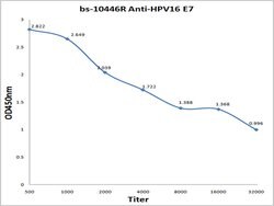 HPV16-E7 Rabbit anti-Virus, Polyclonal, Bioss 100 &mu;L; Unconjugated:Antibodies,