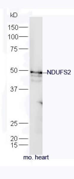 NDUFS2 Rabbit anti-Human, Polyclonal, Bioss 100 &mu;L; Unconjugated:Antibodies,