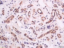 Phospho-CD18 (Thr758) Rabbit anti-Human, Polyclonal, Bioss 100 &mu;L | Buy Online | Bioss | Fisher Scientific