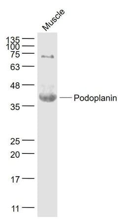 Podoplanin Rabbit anti-Human, Polyclonal, Bioss 100 &mu;L; Unconjugated:Antibodies,