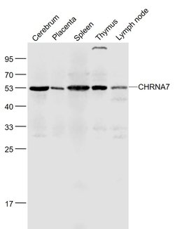 CHRNA7 Rabbit anti-Human, Polyclonal, Bioss 100 &mu;L; Unconjugated:Antibodies,