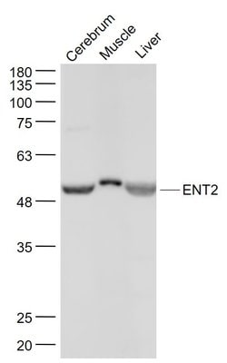 ENT2 Rabbit anti-Human, Polyclonal, Bioss 100 &mu;L; Unconjugated:Antibodies,