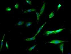 Integrin Alpha 3 + Beta 1 Rabbit anti-Human Mouse Rat, Polyclonal, Bioss