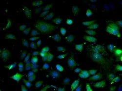 Integrin Alpha 3 + Beta 1 Rabbit anti-Human Mouse Rat, Polyclonal, Bioss