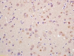 Dopamine D1 Receptor Rabbit anti-Human, Polyclonal, Bioss 100 &mu;L; Unconjugated:Antibodies,