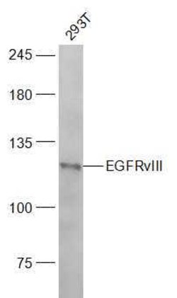 EGFRvIII Rabbit anti-Human, Polyclonal, Bioss 100 &mu;L; Unconjugated:Antibodies,