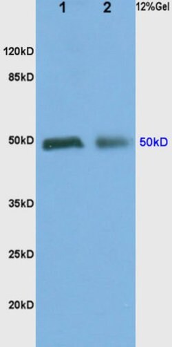 ADRA2 Rabbit anti-Human, Polyclonal, Bioss 100 &mu;L; Unconjugated:Antibodies,