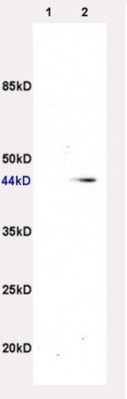 beta 3 Adrenergic Receptor Rabbit anti-Human, Polyclonal, Bioss 100 &mu;L;