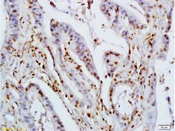KLF2/4 Rabbit anti-Human, Polyclonal, Bioss 100 &mu;L; Unconjugated:Antibodies,