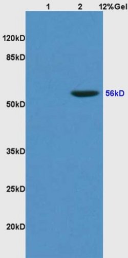 KLF2/4 Rabbit anti-Human, Polyclonal, Bioss 100 &mu;L; Unconjugated:Antibodies,