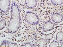 CCL1 Rabbit anti-Human, Polyclonal, Bioss 100 &mu;L; Unconjugated:Antibodies,