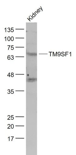 TM9SF1 Rabbit anti-Human, Polyclonal, Bioss 100 &mu;L; Unconjugated:Antibodies,