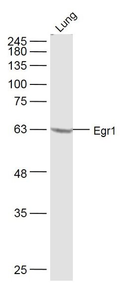 Egr1 Rabbit anti-Human, Polyclonal, Bioss 100 &mu;L; Unconjugated:Antibodies,