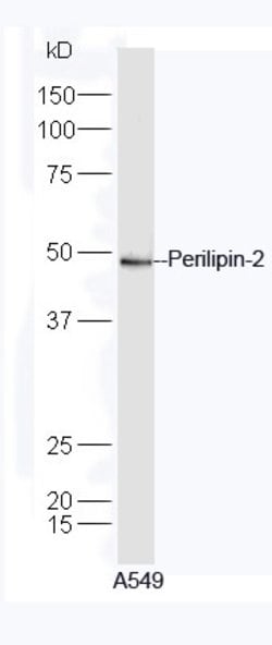Perilipin 2 Rabbit anti-Human, Polyclonal, Bioss 100 &mu;L; Unconjugated:Antibodies,