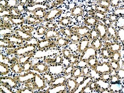 Laminin alpha 5 Rabbit anti-Human, Polyclonal, Bioss 100 &mu;L; Unconjugated:Antibodies,
