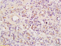 Angiopoietin 4 Rabbit anti-Human, Polyclonal, Bioss 100 &mu;L; Unconjugated:Antibodies,
