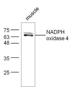 NADPH oxidase 4 Rabbit anti-Human, Polyclonal, Bioss 100 &mu;L | Buy Online | Bioss | Fisher Scientific
