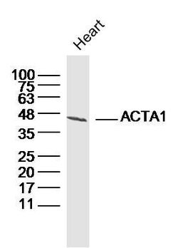 Actin Rabbit anti-Human, Polyclonal, Bioss 100 &mu;L; Unconjugated:Antibodies,