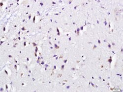 RCAS1/EBAG9 Rabbit anti-Human, Polyclonal, Bioss 100 &mu;L; Unconjugated:Antibodies,