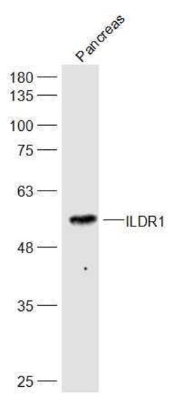 ILDR1 Rabbit anti-Human, Polyclonal, Bioss 100 &mu;L; Unconjugated:Antibodies,