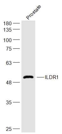 ILDR1 Rabbit anti-Human, Polyclonal, Bioss 100 &mu;L; Unconjugated:Antibodies,