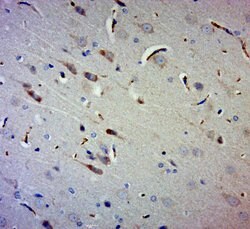 Gigaxonin Rabbit anti-Human, Polyclonal, Bioss 100 &mu;L; Unconjugated:Antibodies,