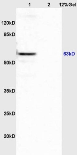 APBA3/Mint3/X11gamma Rabbit anti-Human, Polyclonal, Bioss 100 &mu;L; Unconjugated:Antibodies,