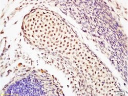 OCT4 Rabbit anti-Human, Polyclonal, Bioss 100 &mu;L; Unconjugated:Antibodies,