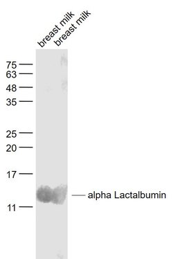 LALBA/alpha Lactalbumin Rabbit anti-Human, Polyclonal, Bioss 100 &mu;L;