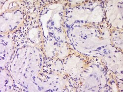 SPRR3/Cornin B Rabbit anti-Human, Polyclonal, Bioss 100 &mu;L; Unconjugated:Antibodies,