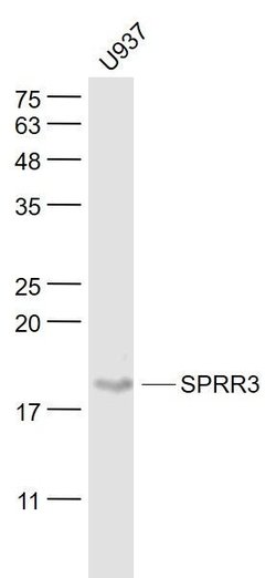 SPRR3/Cornin B Rabbit anti-Human, Polyclonal, Bioss 100 &mu;L; Unconjugated:Antibodies,