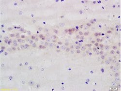AMPK beta 1 + 2 Rabbit anti-Human Mouse Rat, Polyclonal, Bioss 100 &mu;L;