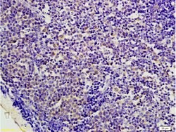 AMPK beta 1 + 2 Rabbit anti-Human Mouse Rat, Polyclonal, Bioss 100 &mu;L;