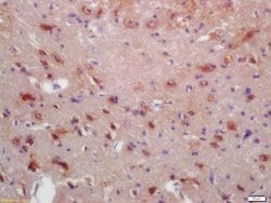 MYRF/C11orf9 Rabbit anti-Human, Polyclonal, Bioss 100 &mu;L; Unconjugated:Antibodies,