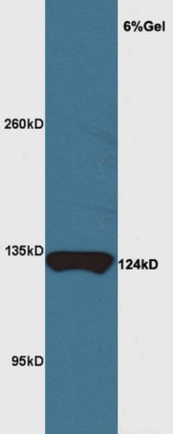 MYRF/C11orf9 Rabbit anti-Human, Polyclonal, Bioss 100 &mu;L; Unconjugated:Antibodies,