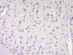 ProSAPiP1 Rabbit anti-Human, Polyclonal, Bioss 100 &mu;L; Unconjugated:Antibodies,