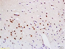 Sema3A Rabbit anti-Human, Polyclonal, Bioss 100 &mu;L; Unconjugated:Antibodies,