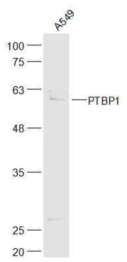 PTBP1 Rabbit anti-Human, Polyclonal, Bioss 100 &mu;L; Unconjugated:Antibodies,