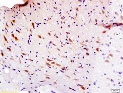 Sema3F/semaphorin 3F Rabbit anti-Human, Polyclonal, Bioss 100 &mu;L; Unconjugated:Antibodies,