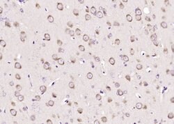 Sema3F/semaphorin 3F Rabbit anti-Human, Polyclonal, Bioss 100 &mu;L; Unconjugated:Antibodies,