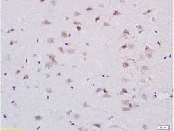 5-HTR1A Rabbit anti-Human, Polyclonal, Bioss 100 &mu;L; Unconjugated:Antibodies,