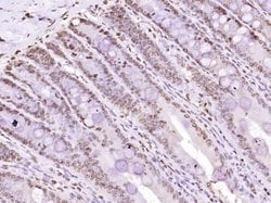 MYO6/Myosin VI Rabbit anti-Human, Polyclonal, Bioss 100 &mu;L; Unconjugated:Antibodies,