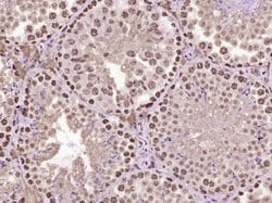 MYO6/Myosin VI Rabbit anti-Human, Polyclonal, Bioss 100 &mu;L; Unconjugated:Antibodies,