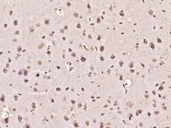 MYO6/Myosin VI Rabbit anti-Human, Polyclonal, Bioss 100 &mu;L; Unconjugated:Antibodies,